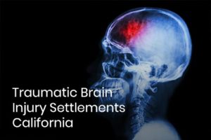 Traumatic Brain Injury Settlements California